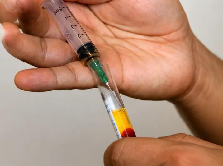 PRP (Plasma Rico en Plaquetas)